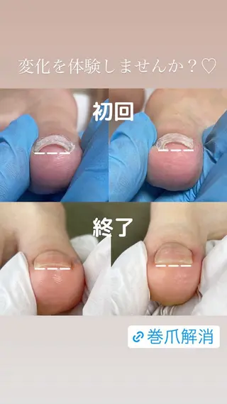 ネイル Estotibi エストティビのその他イメージ