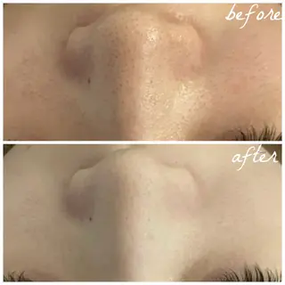 メンズ メナード岐阜茜部 杉浦のエステ・リラクイメージ