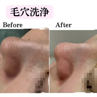 美肌脱毛サロン muroのエステ・リラクイメージ