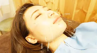 小顔ハーブピーリング 美容鍼/毛穴洗浄のエステ・リラクイメージ