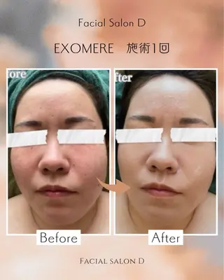 facial salon D 吉沢のエステ・リラクイメージ