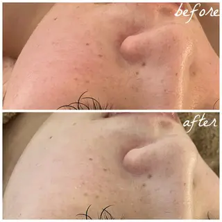 メンズ メナード岐阜茜部 杉浦のエステ・リラクイメージ