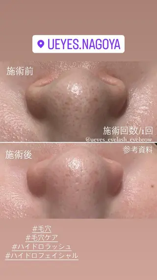 u eyesのマツエク・マツパデザイン