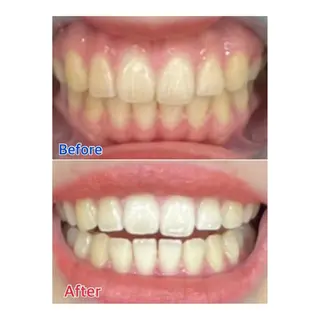 MBEAUTYSALON 千葉店・京成大久保所属・Melty 輝のその他イメージ