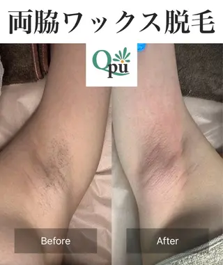 Qpu(キュープ)下北沢店所属・鮎川 さゆりのエステ・リラクイメージ