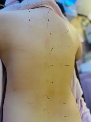 アロマ･美容鍼･カッ ピング「麗」鍼灸院のエステ・リラクイメージ