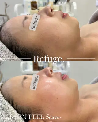 グリーンピール専門サロン Refuge.所属・Refuge. （リフュージュ）のエステ・リラクイメージ