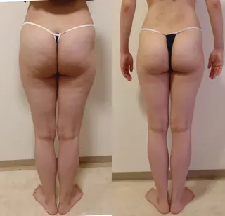 a  room salonのエステ・リラクイメージ