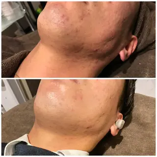 プルケル スパのエステ・リラクイメージ