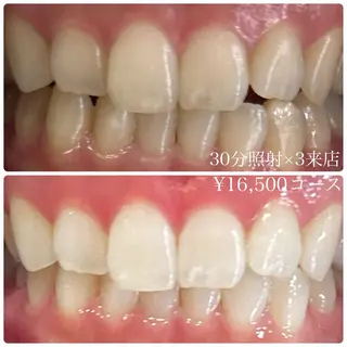 PLATINUM Beauty 横浜店所属・ホワイトニングルーム 横浜店のその他イメージ