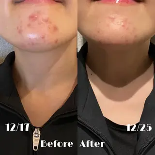 LUMIERE 南堀江店N🤎のエステ・リラクイメージ