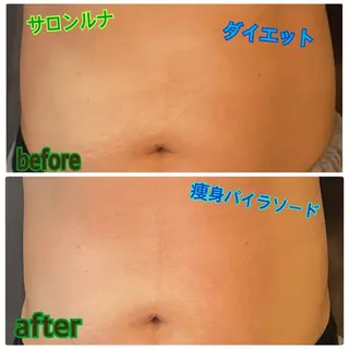 salon ルナのネイルデザイン