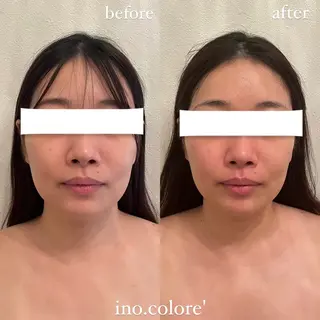 エステサロンino.colore'所属・小顔サロン ino.coloreのエステ・リラクイメージ