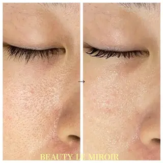 ビューティー ミロワールのエステ・リラクイメージ