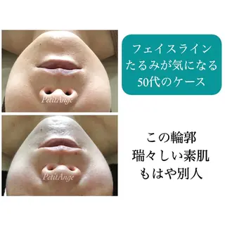 プチアンジェ所属・艶肌&小顔リフト❤︎ プチアンジェ茅ヶ崎のエステ・リラクイメージ