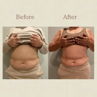 お腹痩せエステ Flat BELLY 恵比寿所属・【腸もみ/冷却痩身】 お腹エステ/恵比寿のエステ・リラクイメージ