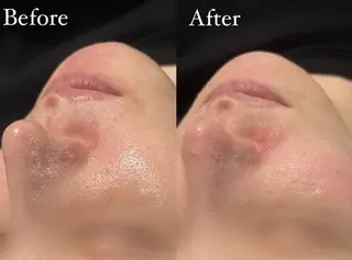 Belle原宿所属・佐藤 加奈のエステ・リラクイメージ