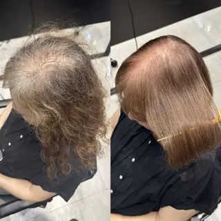 ミディアム GO TODAY 心斎橋edel店所属・白髪ぼかし/髪質 改善/KOMORIのヘアスタイル