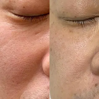 Meetite 小林のエステ・リラクイメージ