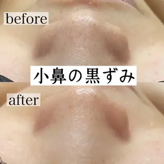 RinRin 甲府店のエステ・リラクイメージ