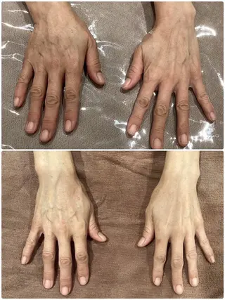 痩身脱毛専門店 Partirのエステ・リラクイメージ