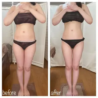 biloop所属・《痩身×疲労改善》 BILOOPのエステ・リラクイメージ