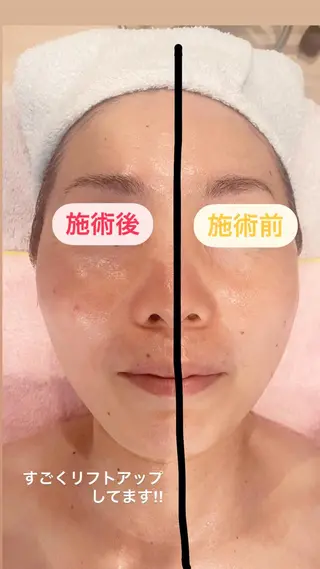 ショート マツエク・マツパ アイブロウ 小倉 麻由のエステ・リラクイメージ