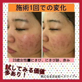 ミディアム パーマ ヘアアレンジ メンズ キッズ ネイル マツエク・マツパ ニキビ・肌質改善専門 ♡人生が変わるサロンのエステ・リラクイメージ