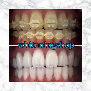 ホワイトニングショップ津店所属・ホワイトニング ショップ津店のその他イメージ