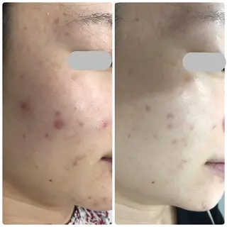 エステティックサロン ベルネのエステ・リラクイメージ