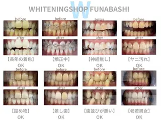 メンズ ホワイトニング ショップ本八幡店のエステ・リラクイメージ