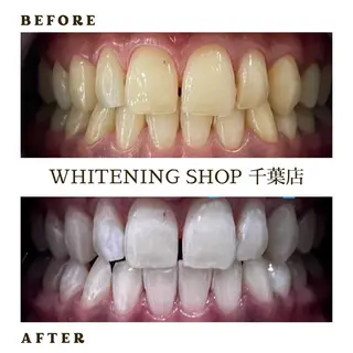 メンズ ホワイトニング ショップ千葉店のその他イメージ