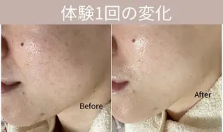 都度払い 肌質改善専門サロンのエステ・リラクイメージ