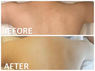 ハーブピーリング横浜 肌質改善専門店のその他イメージ