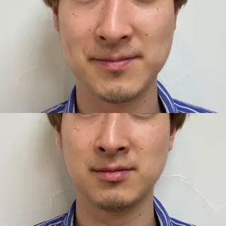 メンズ amy amie salon所属・amy amie 上村のマツエク・マツパデザイン