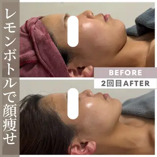 小顔矯正専門店 【RED】池田のエステ・リラクイメージ