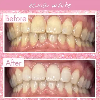 セルフホワイトニング エクシア大府店のその他イメージ