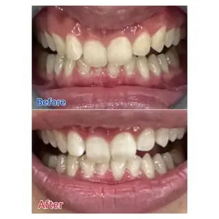 M渋谷店所属・M渋谷 ホワイトニングのエステ・リラクイメージ