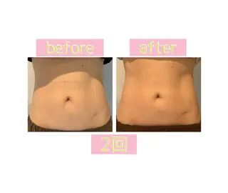 癒し腸もみサロン シャユーム　ゆきなのエステ・リラクイメージ