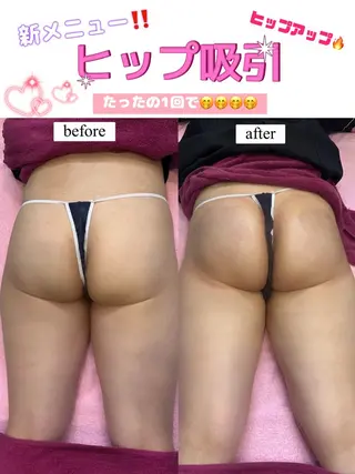 エルフラージュ 銀座店のエステ・リラクイメージ