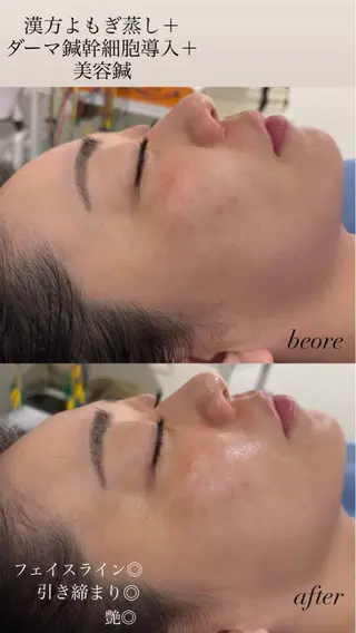 美容鍼灸サロン mahoroba院長のエステ・リラクイメージ