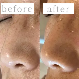 毛穴専門サロン　フルール所属・フルールFululu 自由が丘のエステ・リラクイメージ