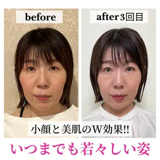 小顔サロン AMYONのエステ・リラクイメージ