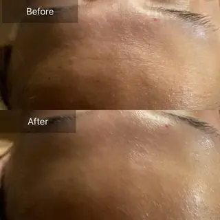 Mandarin Orange所属・毛穴から始める肌メン テマンダリンオレンジのエステ・リラクイメージ