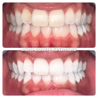 メンズ ライトビューティー 錦糸町店のエステ・リラクイメージ