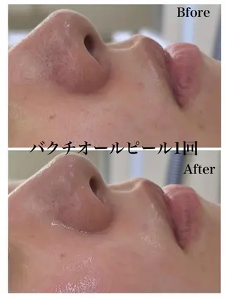 《美肌&小顔サロン》 Masqueradeのエステ・リラクイメージ