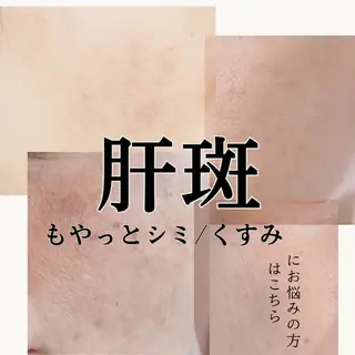 シミ毛穴ケア EsteAのエステ・リラクイメージ