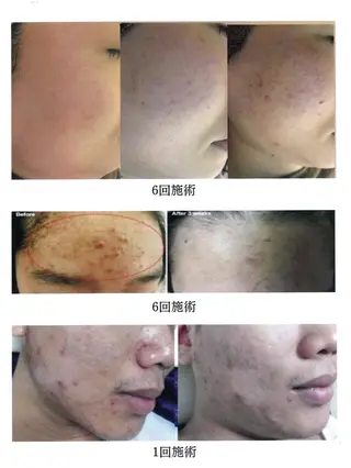 アイアンド ネイルデイのエステ・リラクイメージ