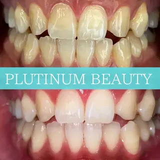 メンズ プラチナム ビューティー横須賀店のその他イメージ