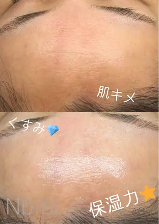 韓国🇰🇷価格 サロン_Nbibiのエステ・リラクイメージ